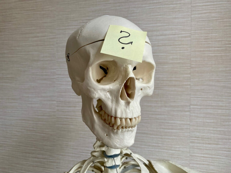 Skelett Schädel mit Post-It auf der Stirn